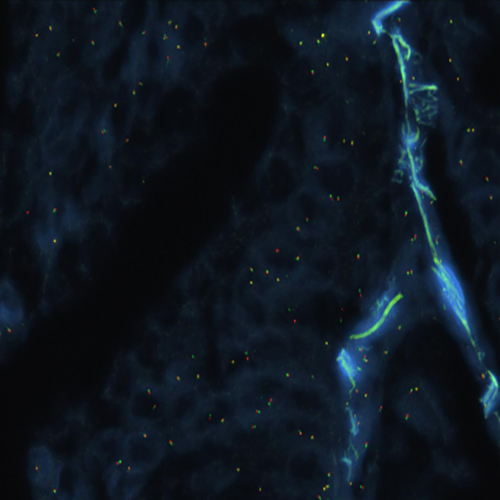 IVD RET Break 产品照片 Front View S