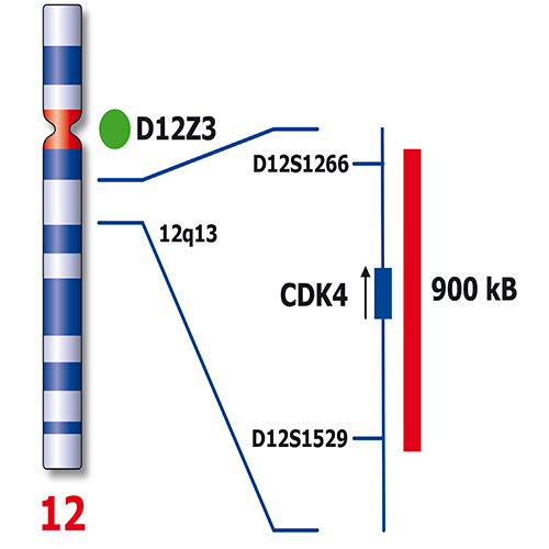 IVD CDK4/SE 12 产品照片 Back View S