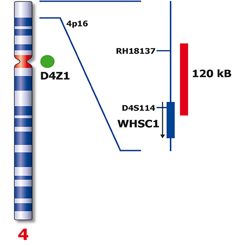 IVD WHSC1/SE 4 产品照片 Back View S