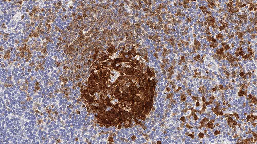 B Cell Specific Octamer Binding Protein1 (BOB-1) 产品照片 Front View S