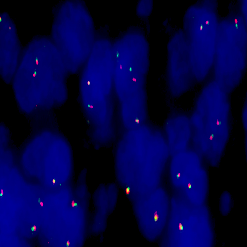 IVD BCL2 (18q21) Break - XL for BOND 产品照片 Front View S