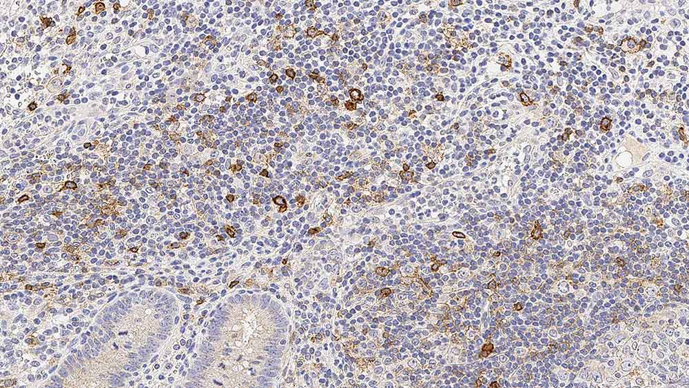 CD25 产品照片 Front View S