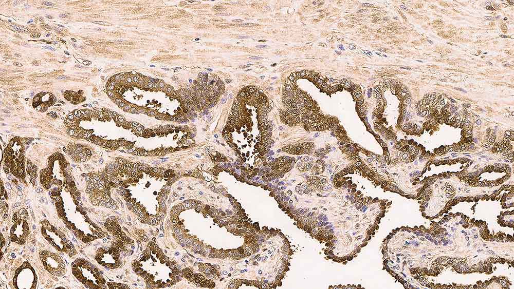 Galectin-3 产品照片 Front View S