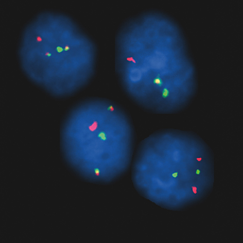 IVD MYEOV/IGH 产品照片 Front View S