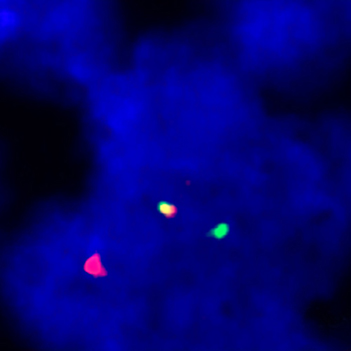 IVD IRF4/DUSP22 Break 产品照片 Front View S