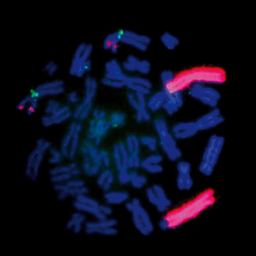 IVD MYCN/AFF3 产品照片