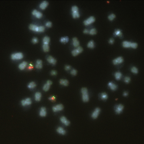 IVD HIRA/SHANK3 产品照片 Front View S