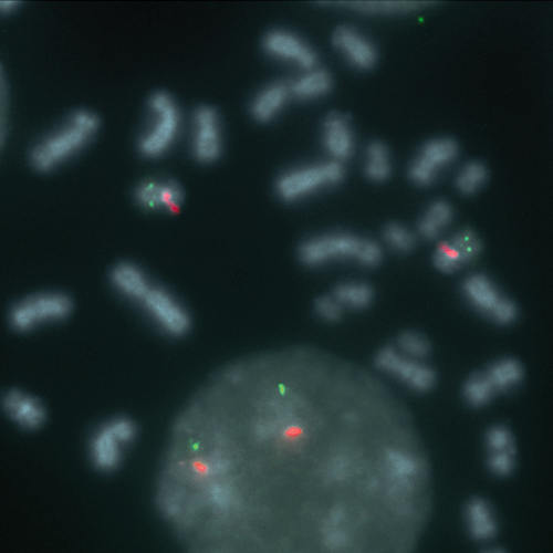 IVD UBE3A/PML 产品照片 Front View S