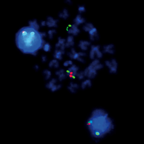 IVD 5q Dual-Color 产品照片 Front View S