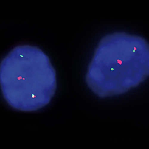 IVD PPARG Break 产品照片 Front View S