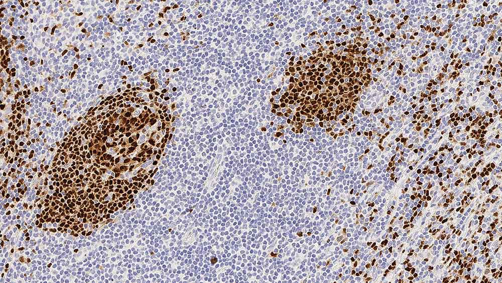 Pax-5 产品照片 Front View S