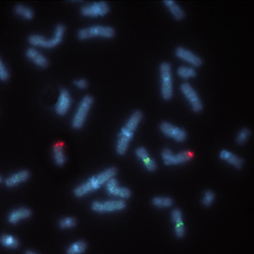 CCND1/IGH t(11;14) Fusion product photo