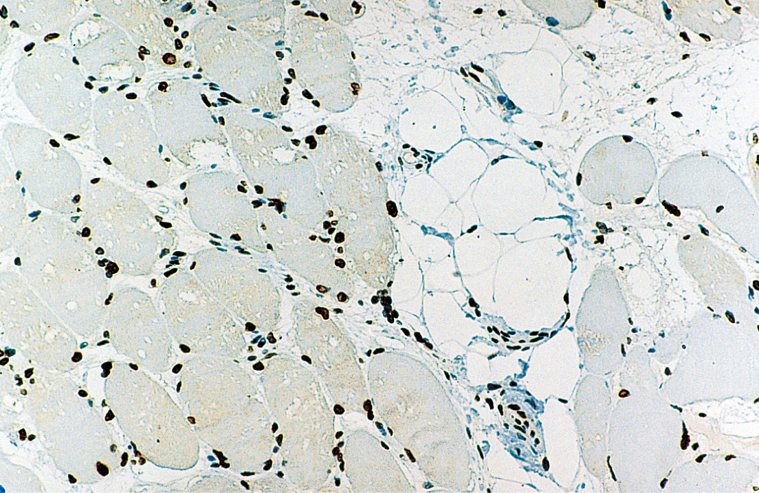 1ml NCL-EMERIN product photo