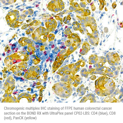 CP02-LBS mxIHC - CD4/CD8/PanCK product photo