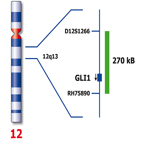 IVD ATM/GLI1 product photo Side View S