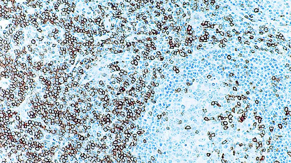 CD5 (liquid primary antibody) 1mL product photo