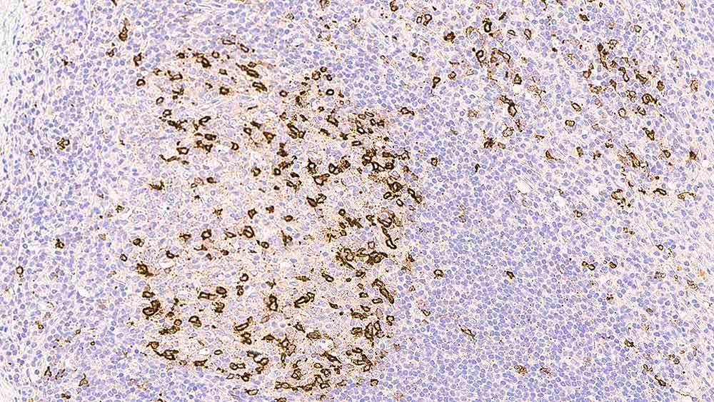 CD57 product photo Front View S