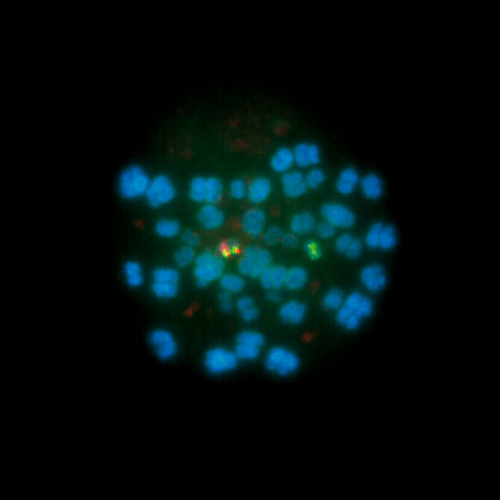 ON p53 (17p13) / SE 17, 20T product photo