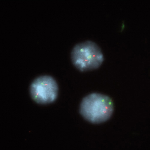 ON MLL (11q23) / SE 11 product photo