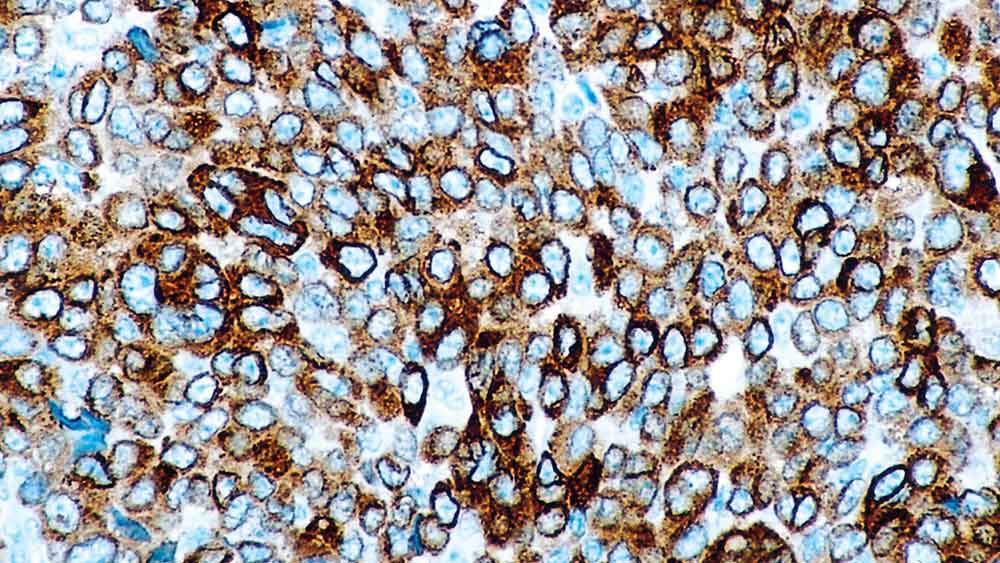 Melan A (liquid primary antibody) 1mL product photo