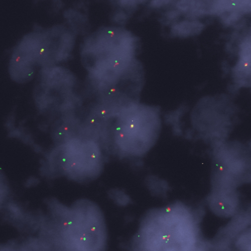 DDIT3 (12q13) Break - XL for BOND product photo