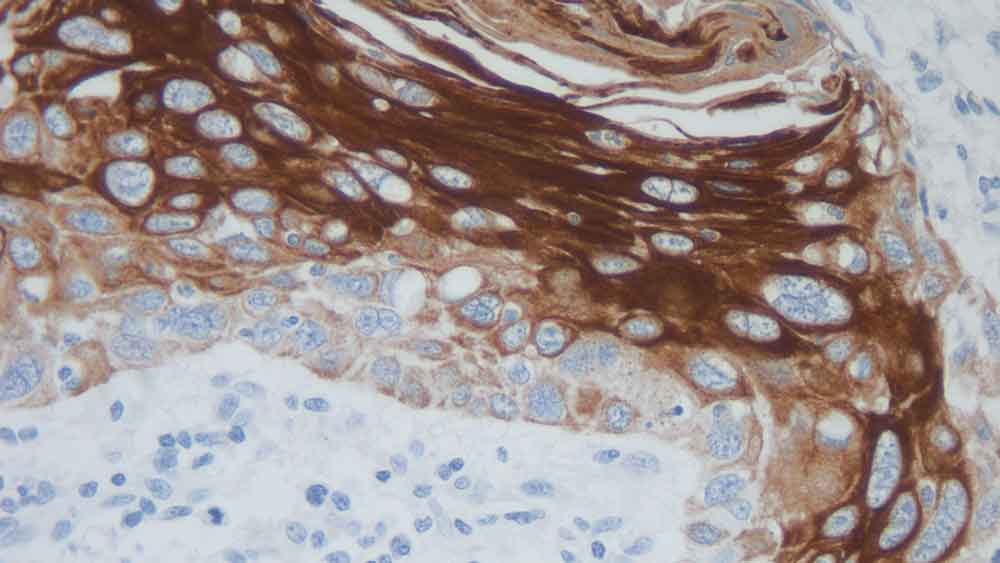 1ml NCL-L-CK17 product photo