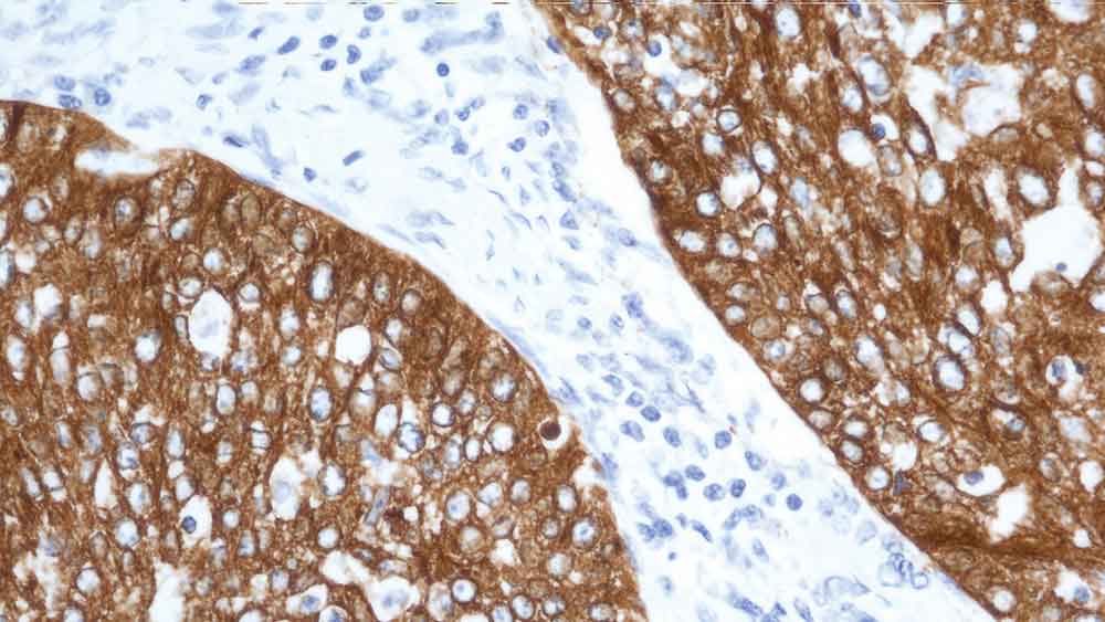 7ml Cytokeratin 19 Bond RTU Primary product photo