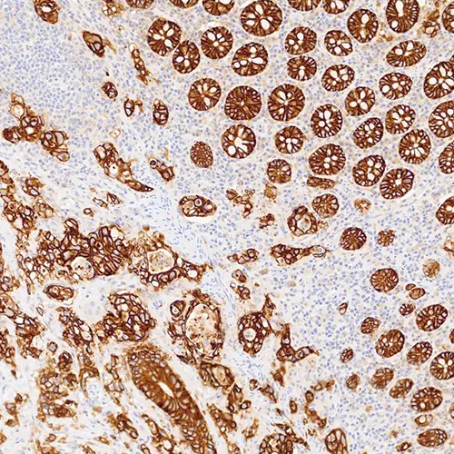 7mL EpCAM (EPR20532-222) Bond RTU product photo