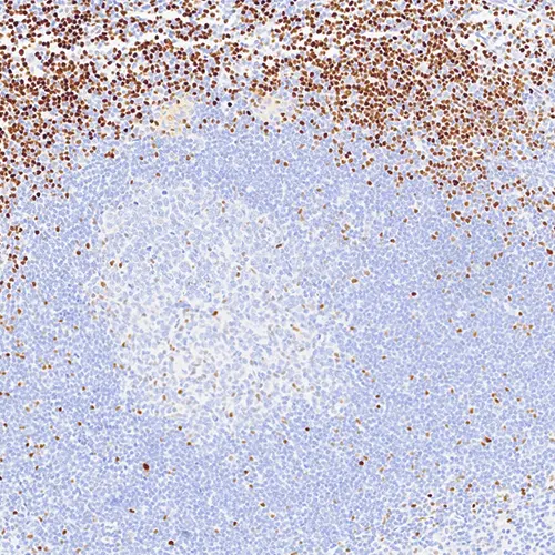 7mL LEF-1 (EPR2029Y) Bond RTU product photo