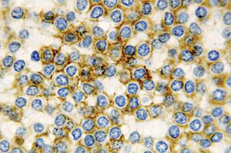 7ml CD11c Bond RTU Primary product photo