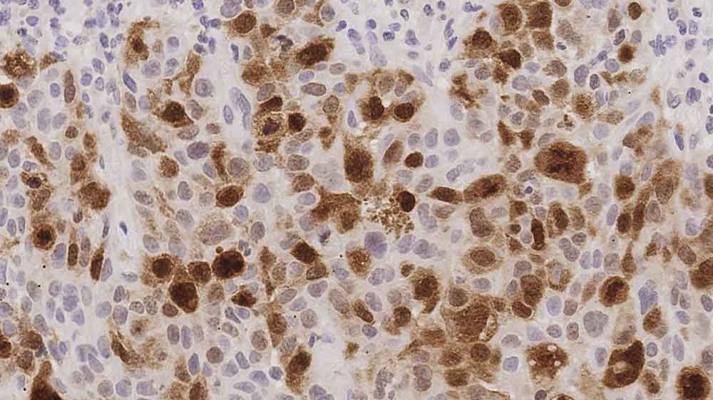 1ml NCL-L-PLK-1 product photo