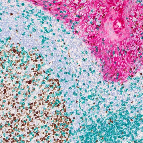 ChromoPlex III Triple Detection RUO product photo