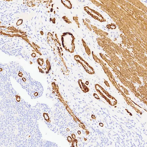 7mL H-Caldesmon (BSB-19) Bond RTU product photo