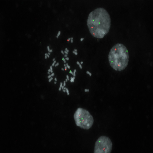 IVD MYC/IGH t(8;14) Fusion 製品画像 Front View S