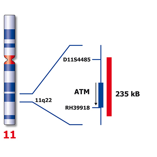 IVD ATM/GLI1 製品画像 Back View S