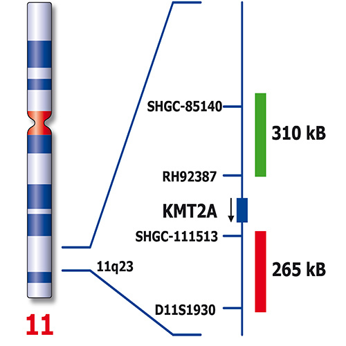 IVD KMT2A Break 製品画像 Back View S