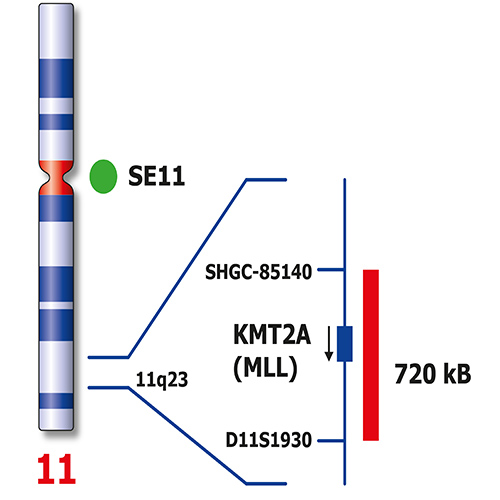 IVD KMT2A/SE 11 製品画像 Back View S