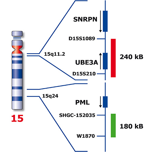 IVD UBE3A/PML 製品画像 Back View S