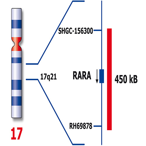 IVD PML/RARA 製品画像 Side View S
