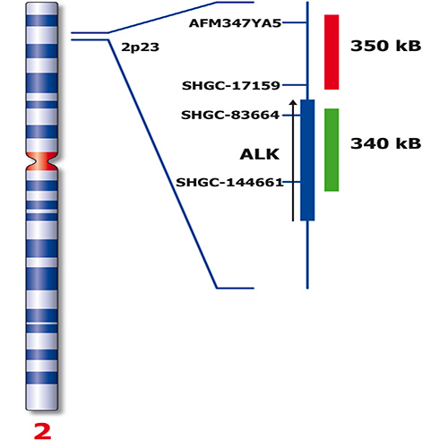 IVD ALK Break 製品画像 Back View S