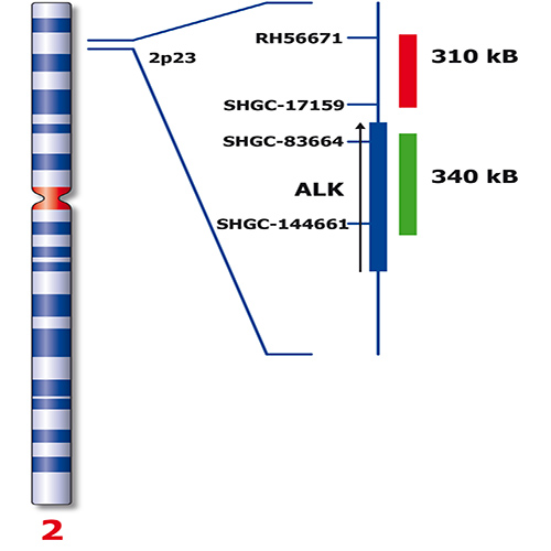 IVD ALK (2p23) Break - XL for BOND 製品画像 Back View S