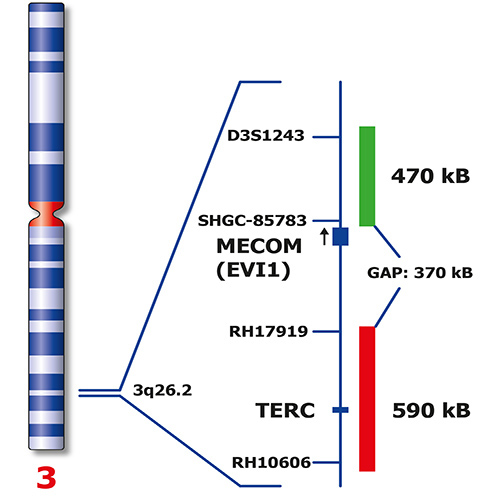 IVD MECOM Break 製品画像 Back View S