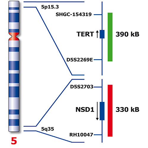 IVD NSD1/TERT 製品画像 Back View S
