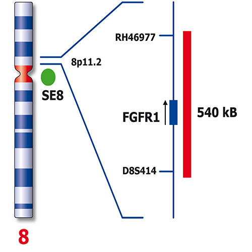 IVD FGFR1 (8p11) / SE8 (D8Z1) - XL for BOND 製品画像 Back View S