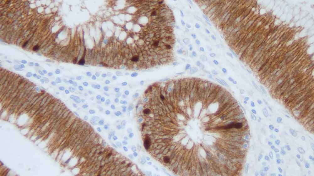 NCL-L-B-CAT,Beta-Catenin,17C2,1mL 製品画像