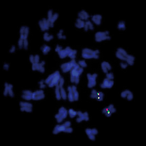IVD CCND1 Break 製品画像