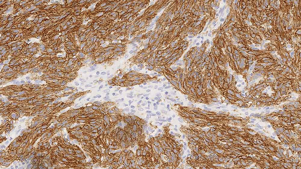 CD117 (c-kit Oncoprotein) 製品画像 Front View S