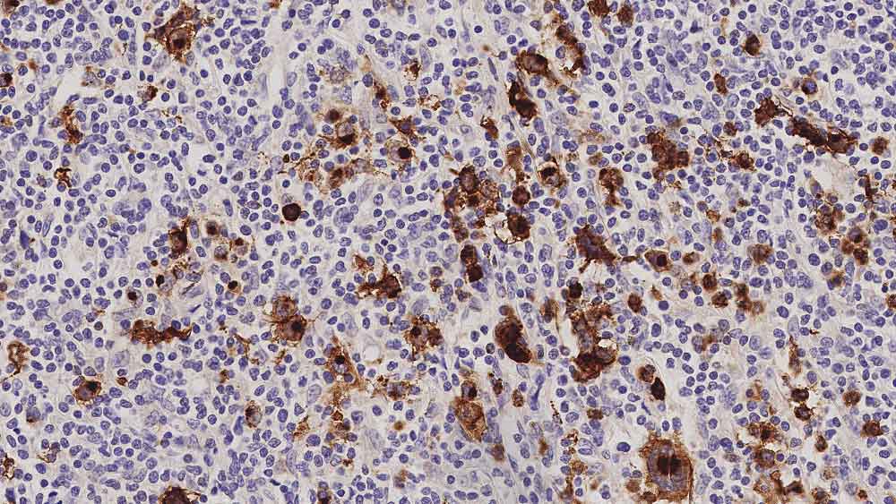 NCL-L-CD15-605,CD15,MMA,1mL 製品画像