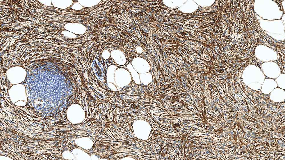 CD34 - IHC Primary Antibodies