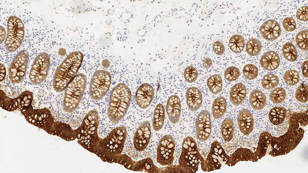 Carcinoembryonic Antigen (CD66e) 製品画像 Front View S